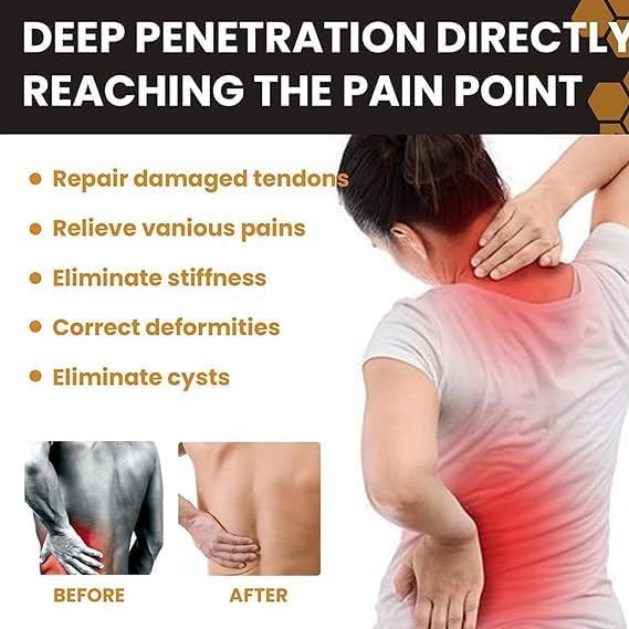 Bee Venom - Joint Soothing Gel (Original)