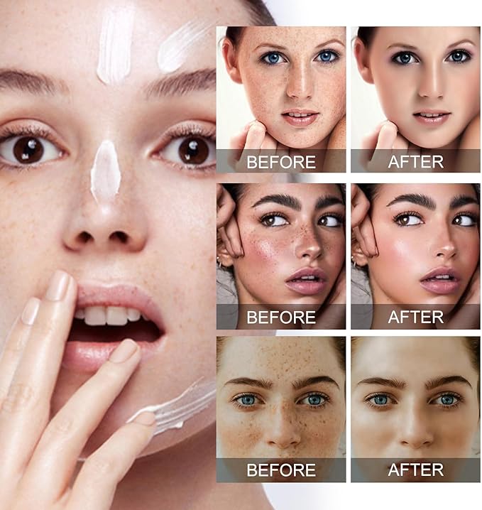 Eelhoe - Dark Spots Removes Cream (Original)