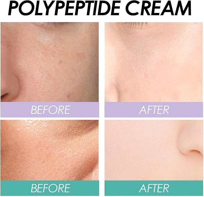 EELHOE - Polypeptide Cream (Original)