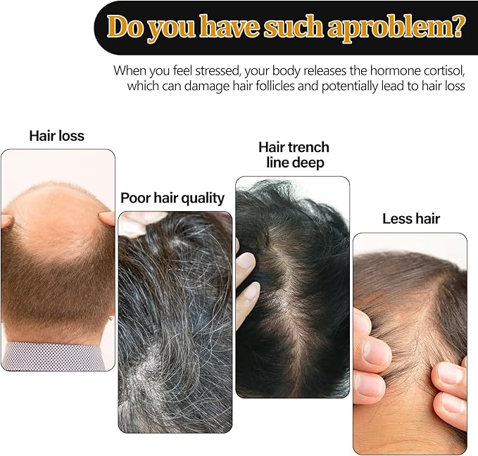 Eelhoe - Root Activation Shampoo (Original)