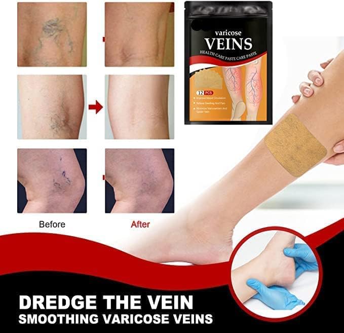 Hanel - Varicose Veins Patch (Original)