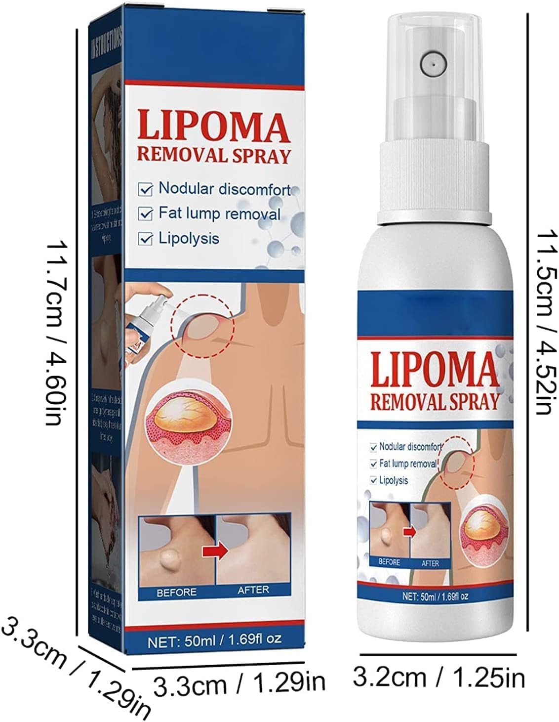 South Moon - Lipoma Removal Spray (Original)