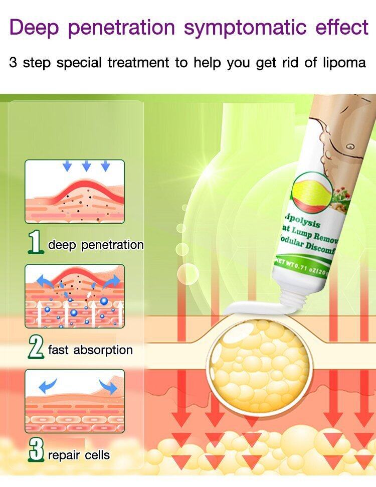 Sumifun - Lipoma Cream (Original)