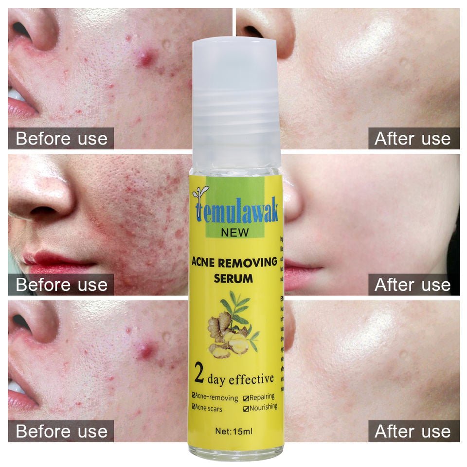 Temulawak - New Acne Removing Serum (Original)