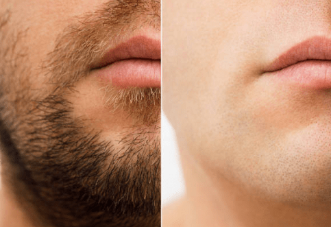 WMARK - Professional Hair Clipper ©