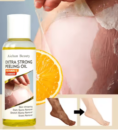 Aichun Beauty - Extra Strong Peeling Oil (Original)
