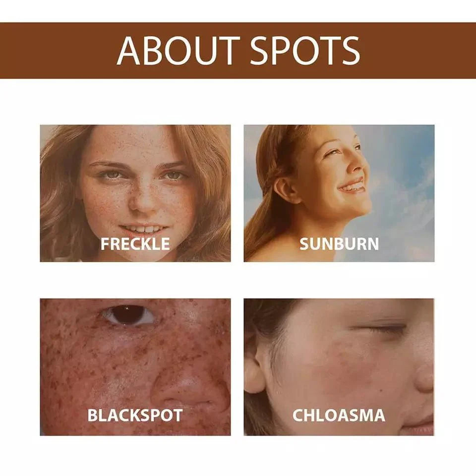 Anti Freckle Serum (Original)