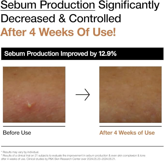 Anua -Rice 70 Glow Milky Toner (Original)