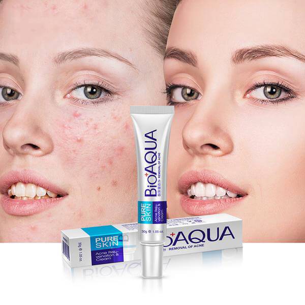 BIOAQUA - Acne Removing and Rejuvenating Cream (Original)