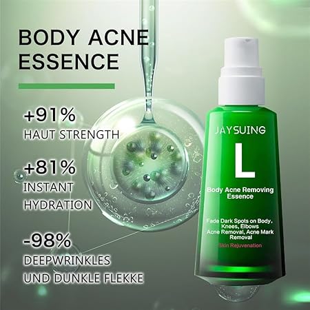 Body Pimple Repair Moisturizer