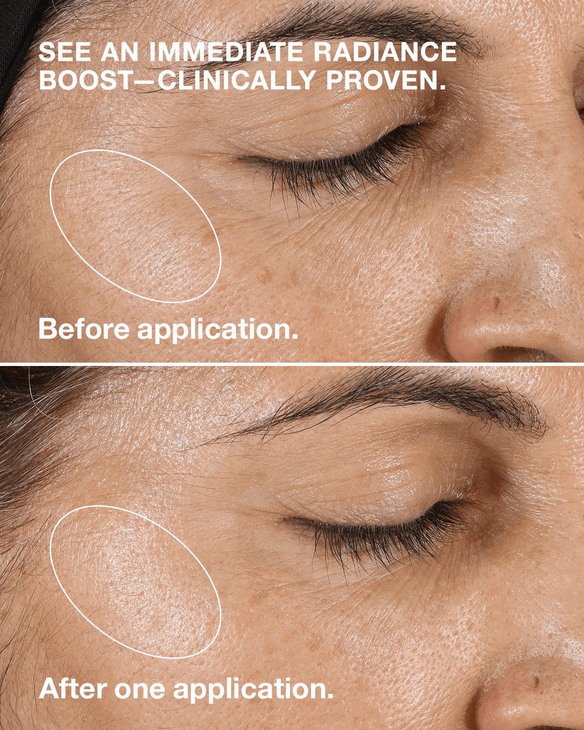 Clinique - Clarifying Lotion (Original) ©