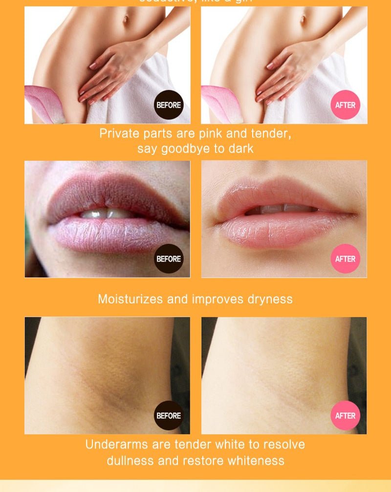 Dr Rashel - Vitamin C Privates Parts Whitening Cream (Original)