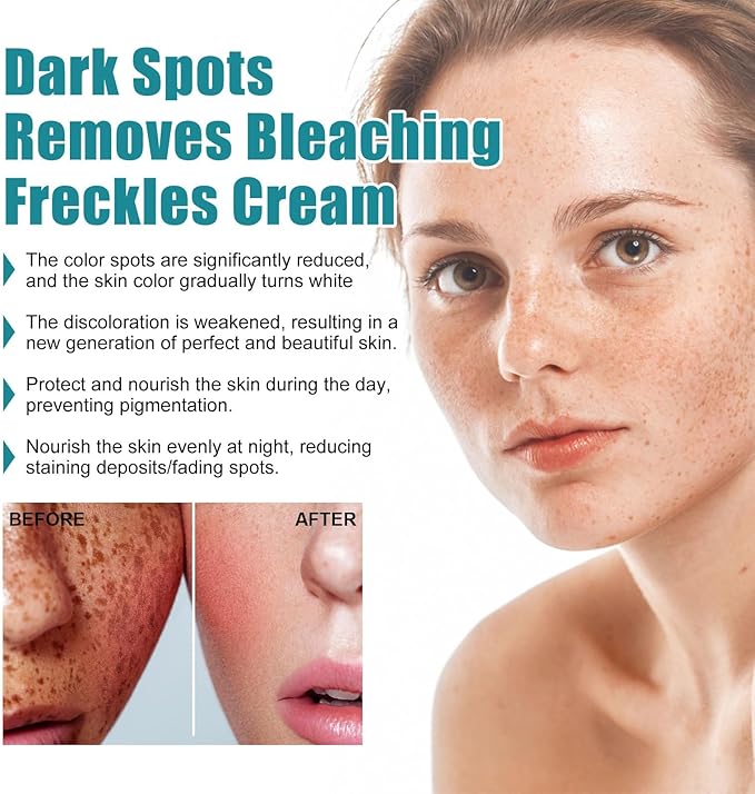 Eelhoe - Dark Spots Removes Cream (Original)