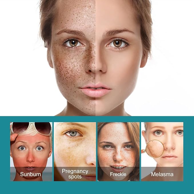 Eelhoe - Dark Spots Removes Cream (Original)