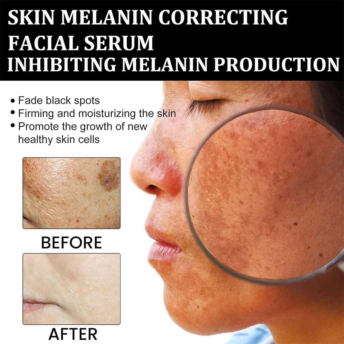 Eelhoe - Melanin Correcting Serum (Original)