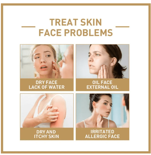 Eelhoe - Rice Toner (Original)