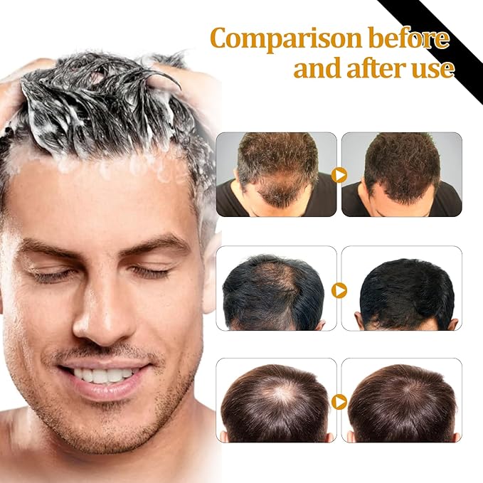 Eelhoe - Root Activation Shampoo (Original)