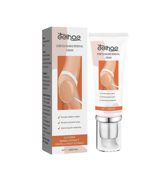 Eelhoe - Stretch Marks Removal Cream (Original)