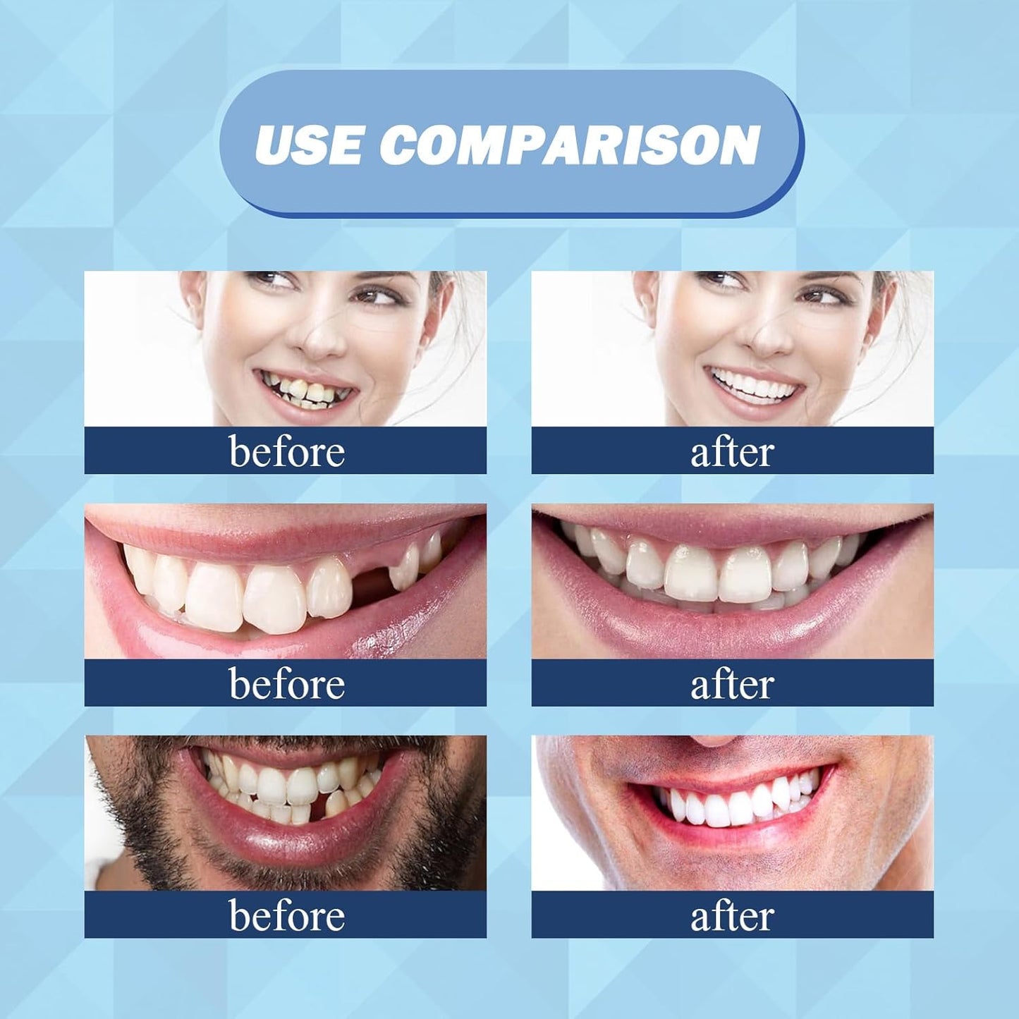 Eelhoe - Thermal Forming False Teeth (Original)