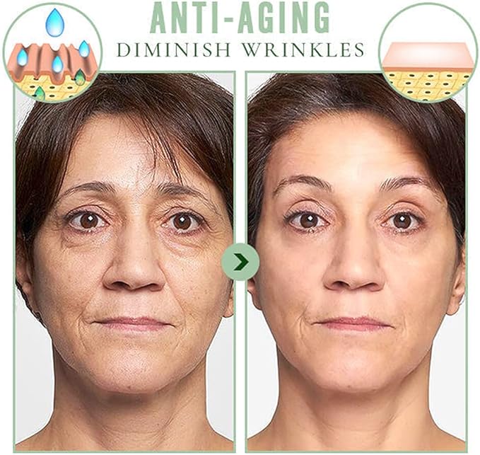 Eelhoe - Wash Free Collagen Firming Mask (Original)