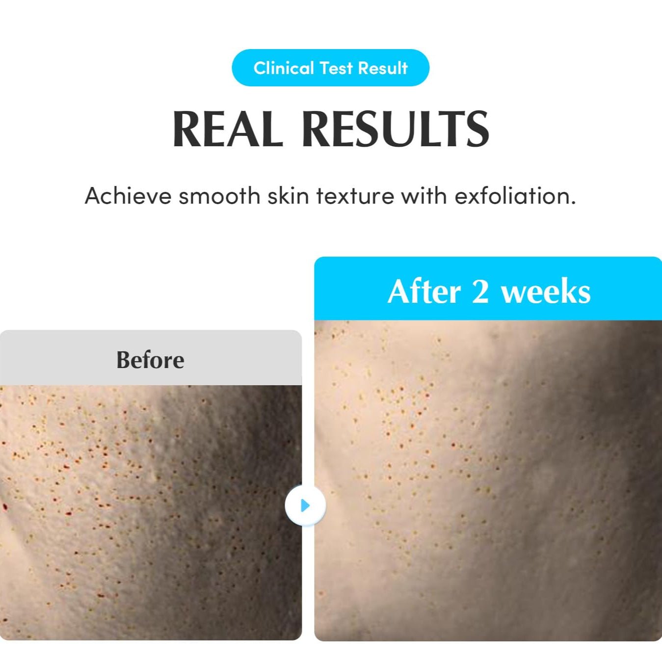 EQQUALBERRY - Swimming Pool Toner (Original)