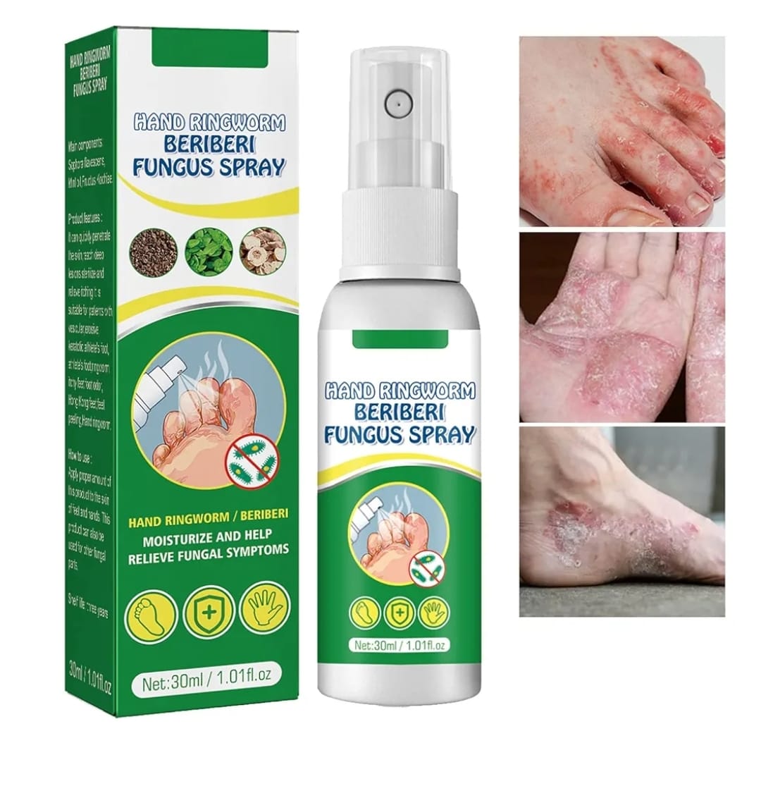 Hand Ringworm Beriberi Fungus Spray (Original)