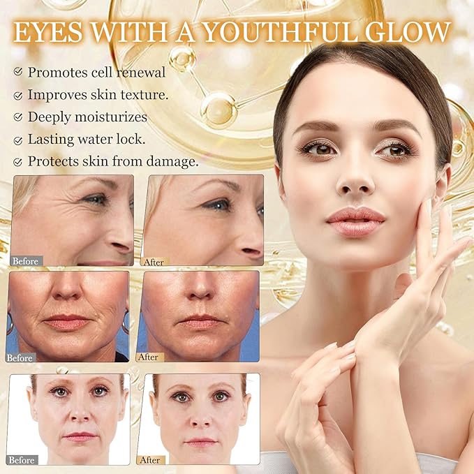 Hoygi - Retinol & Bee Venom Line Capsules (Original)