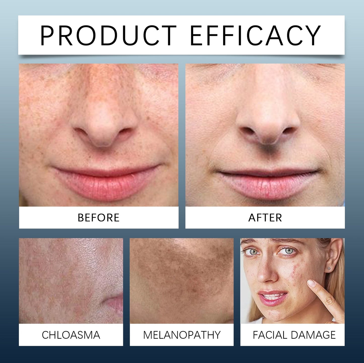 Jaysuing - Day & Night Cream Kit (Original)