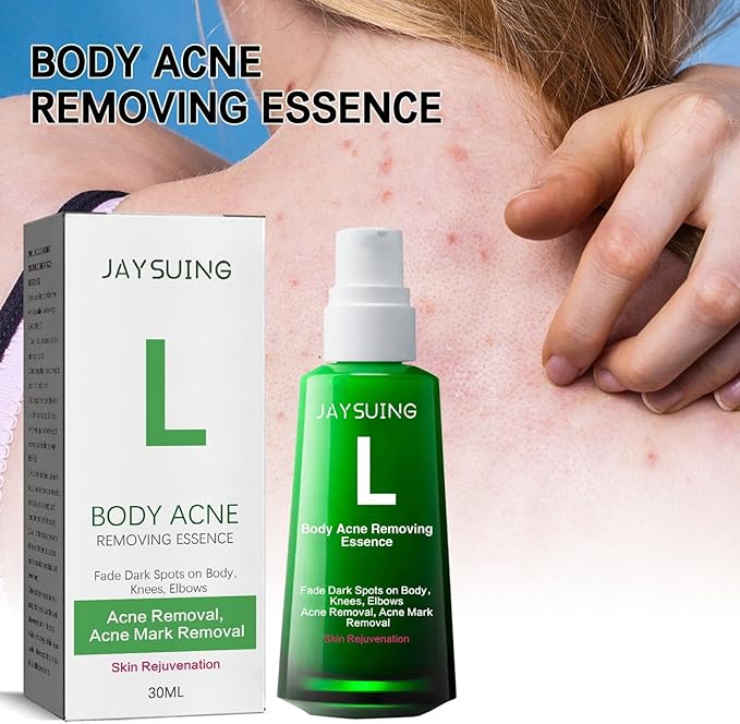 Jaysuing - L ' Body Acne Removing Essence (Original)