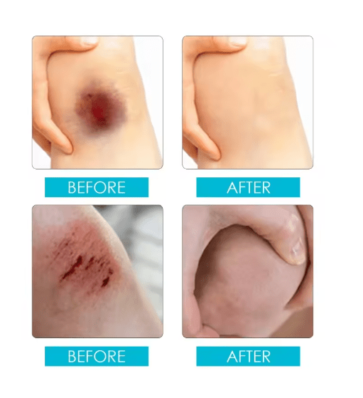 Jaysuing - Liquid Wound Dressing (Original)