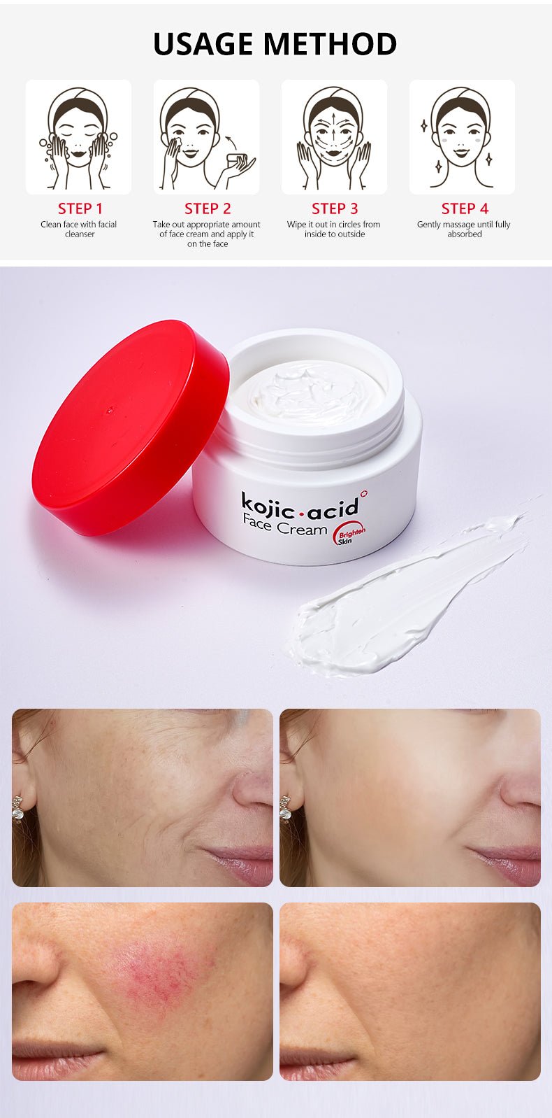 Kojic Acid Skincare Series (Original)