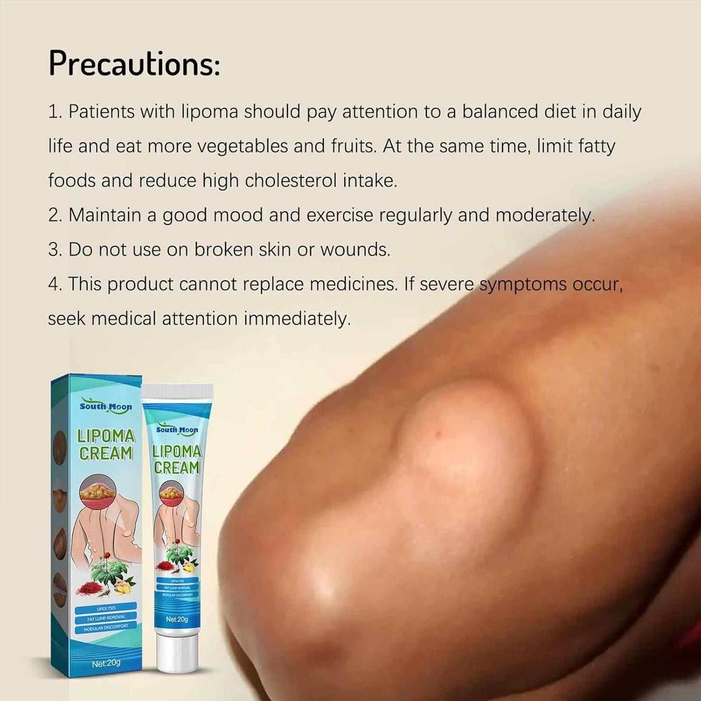 Lipoma Cyst Remover Cream