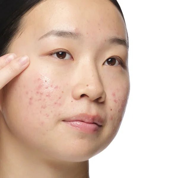 Ordinary. Aloe 2% + Nag 2% Solution (Original)