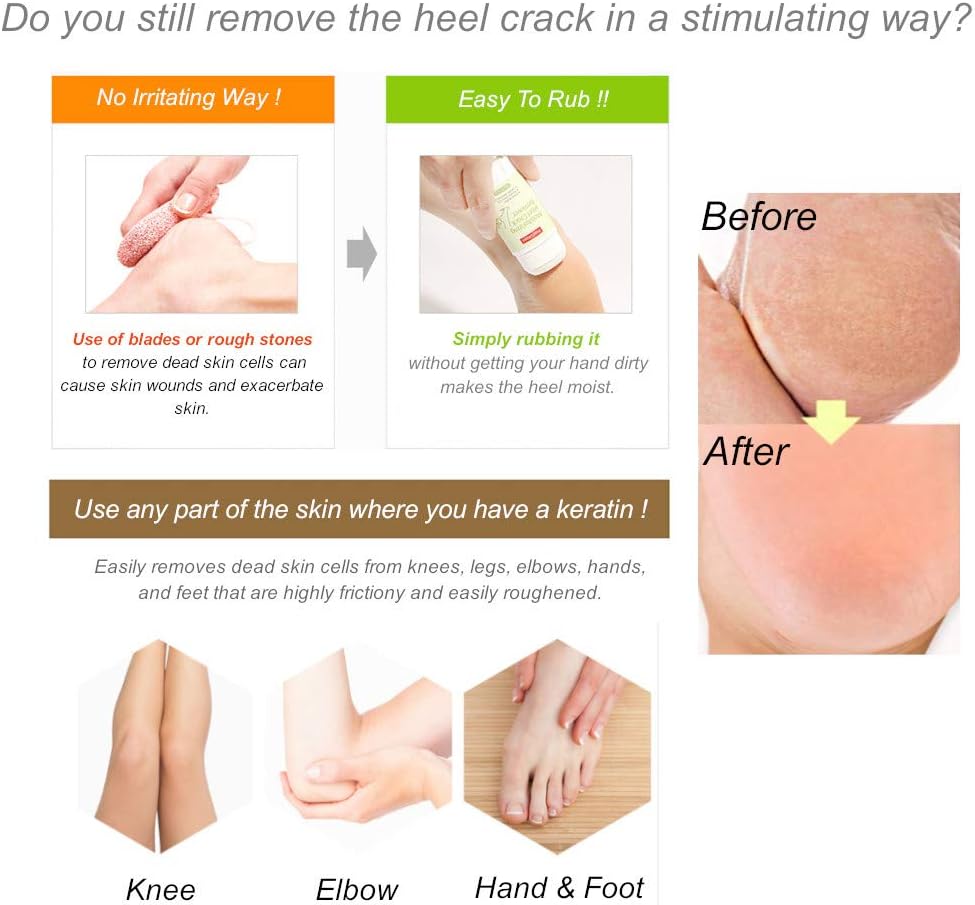 Purederm - Moisturizing Heel Crack Remover (Original)