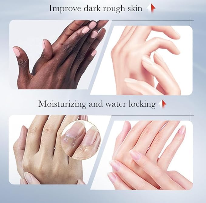 Sadoer - Kojic Acid Hand Cream (Original)