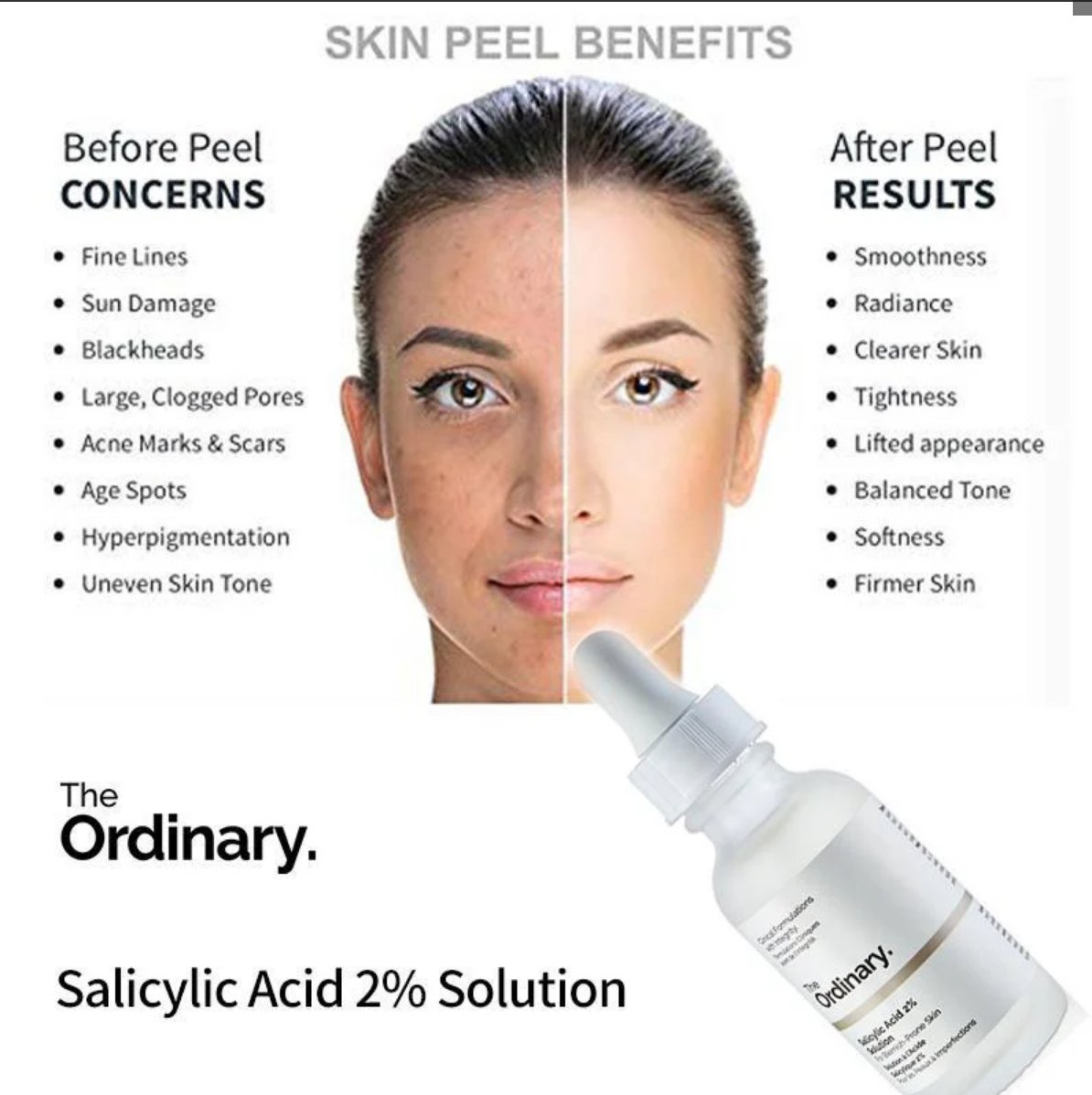 Salicylic Acid 2% Solution (Original)