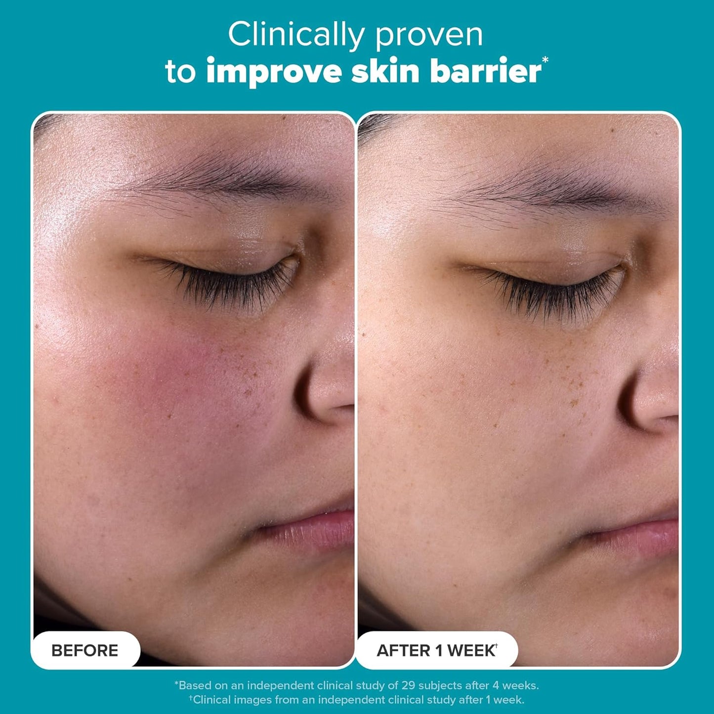 Skin Perfecting 2% BHA Liquid Exfoliant (Original)