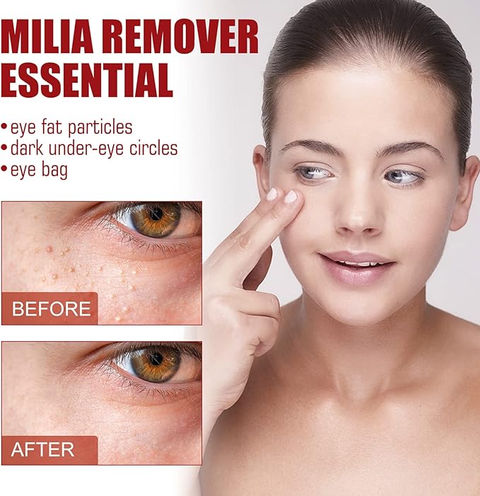 Smooth Milia Remover Serum (Original)