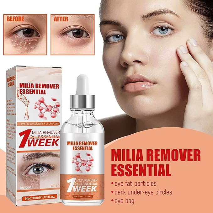 Smooth Milia Remover Serum (Original)