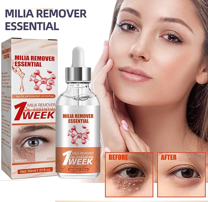 Smooth Milia Remover Serum (Original)