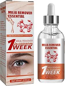 Smooth Milia Remover Serum (Original)