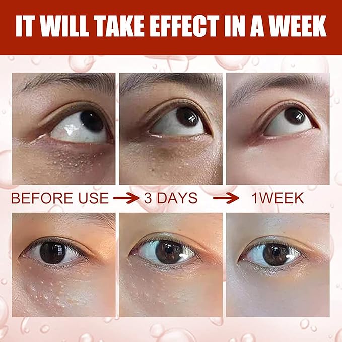 Smooth Milia Remover Serum (Original)