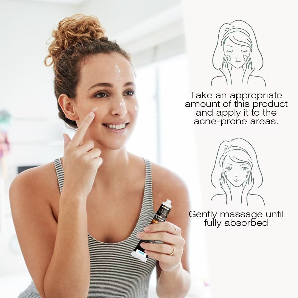 Snmifun - Bee Anti-Acne Gel (Original)