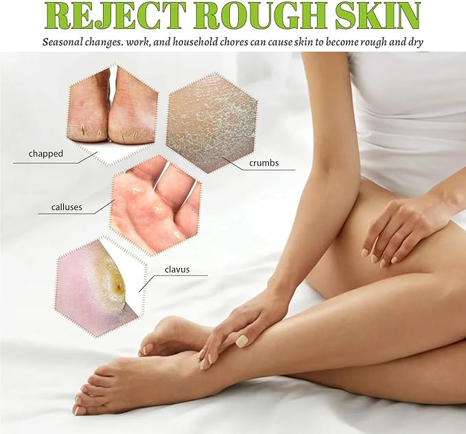 South Moon - 42% Urea Cream (Original)