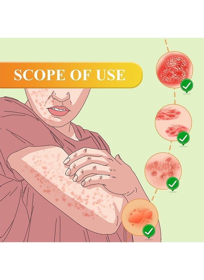 South Moon - Bee Venom Psoriasis Care Cream (Original)