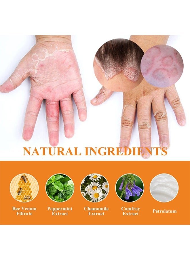 South Moon - Bee Venom Psoriasis Care Cream (Original)