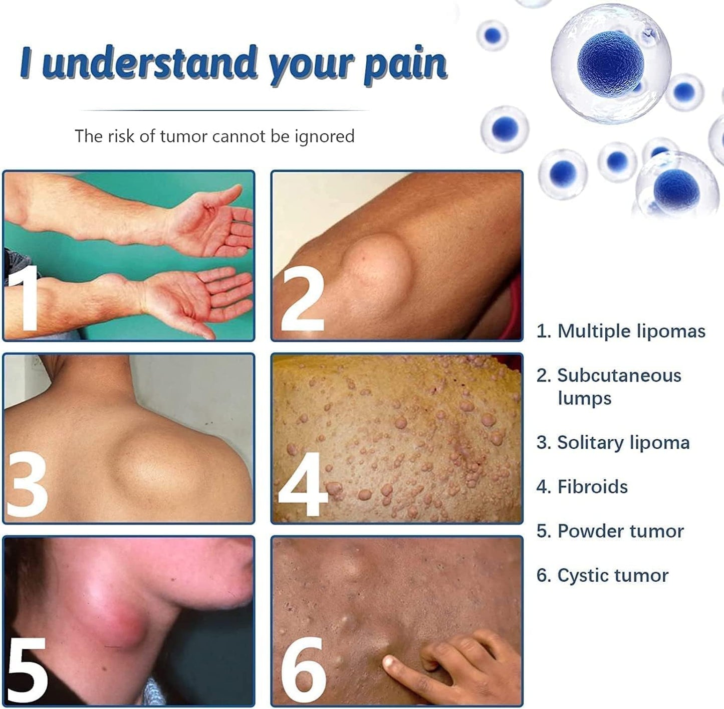 South Moon - Lipoma Removal Spray (Original)