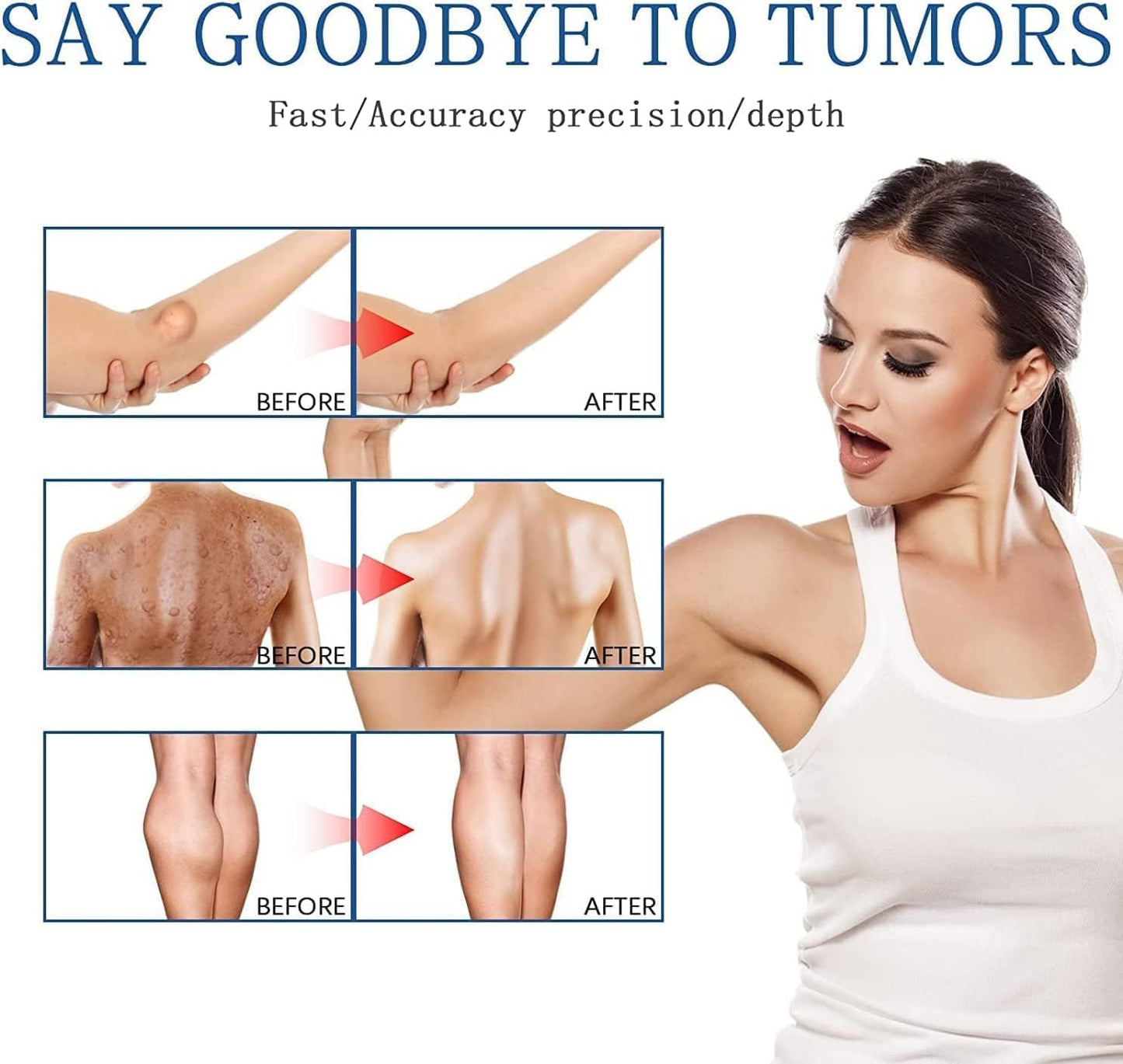 South Moon - Lipoma Removal Spray (Original)