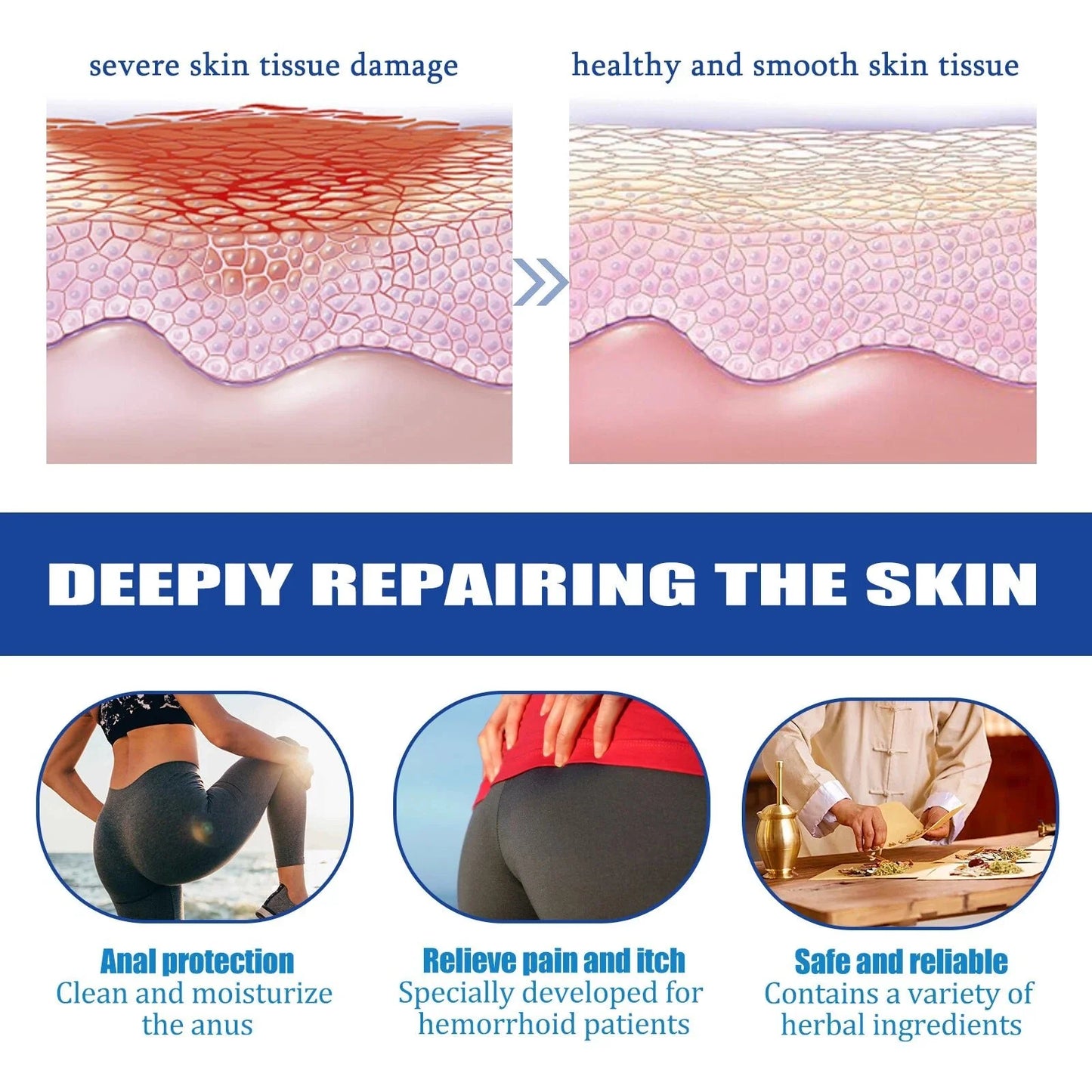 South Moon - Strength Hemorrhoids Capsules (Original)