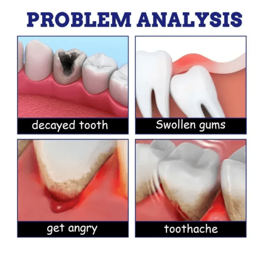 South Moon - Toothache Spray (Original)